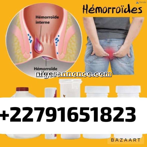 Hémorroïdes -  contrôler bien l'état de nos santé | Niger annonce